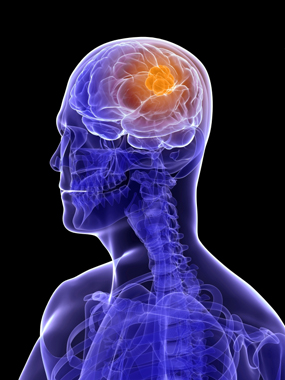 Brain Tumor Care at Georgia Regents Neuroscience Center
